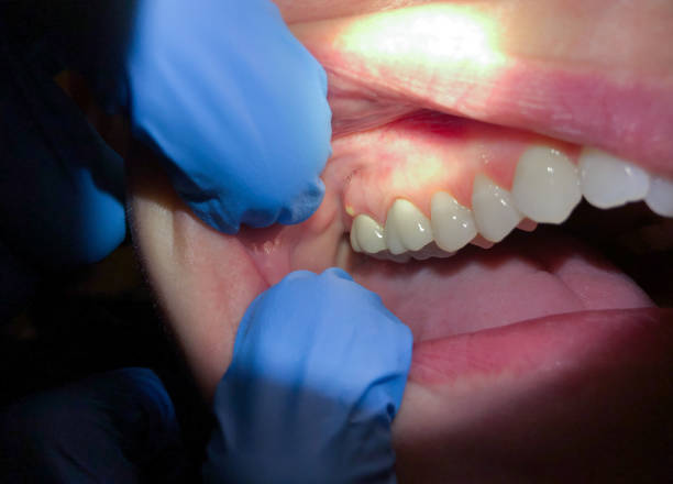 Best Emergency Dentist Near Me  in Pineville, KY